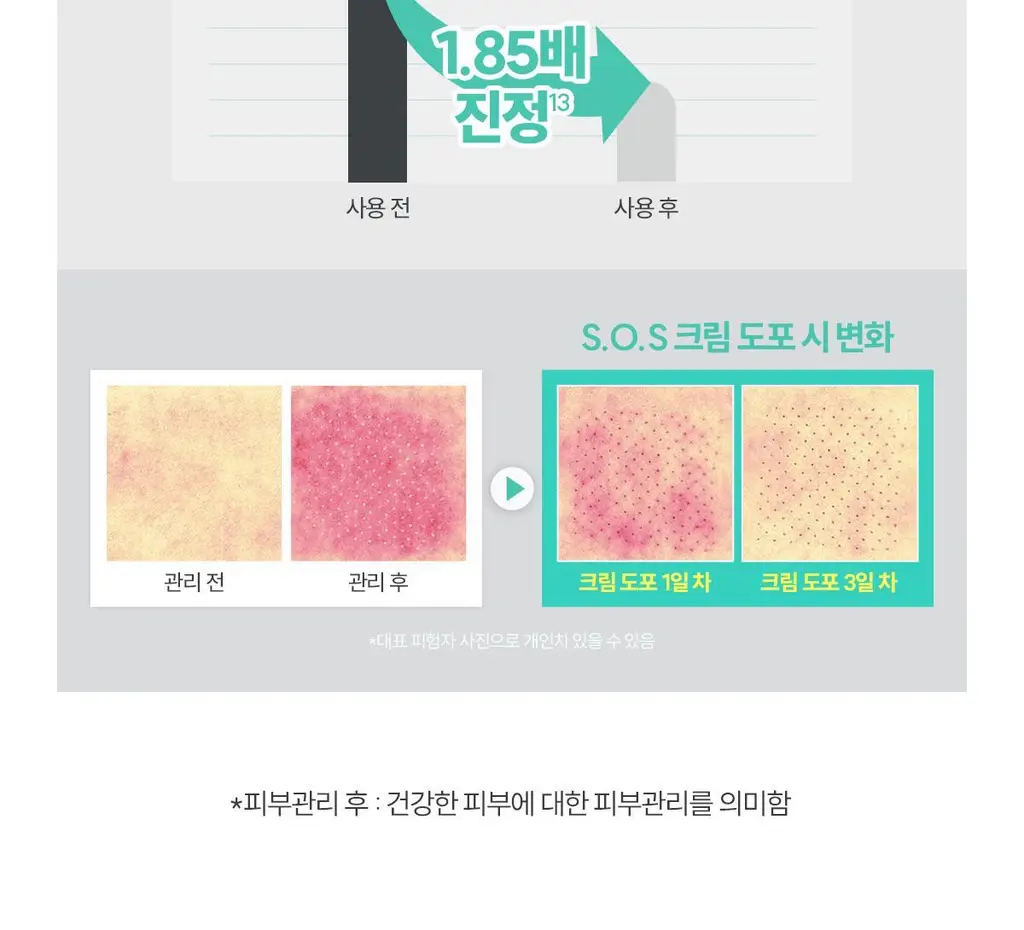 [손상/장벽 리페어] 아벤느 시칼파트 플러스 SOS 리페어 크림 100ml 2입 기획 상세페이지 14